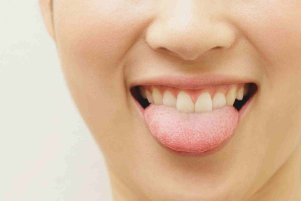 10 Penyebab Lidah Terasa Pahit dan Cara Mengatasinya