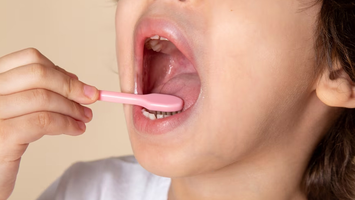 7 Alasan Kenapa Lidah Perlu Disikat Rutin