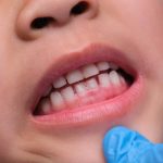 10 Cara Menjaga Kesehatan Gusi untuk Anak-anak