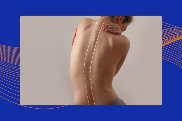 7 Cara Mencegah Skoliosis Sejak Usia Muda 7 Cara Mencegah Skoliosis Sejak Usia Muda