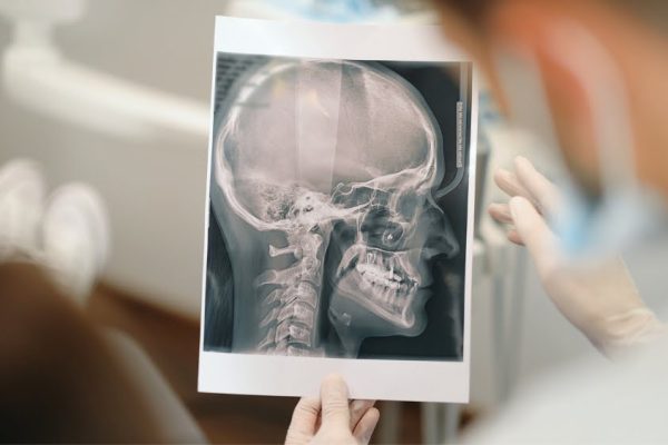 7 Cara Deteksi Dini Gangguan Tengkorak dengan Pemeriksaan Medis 7 Cara Deteksi Dini Gangguan Tengkorak dengan Pemeriksaan Medis