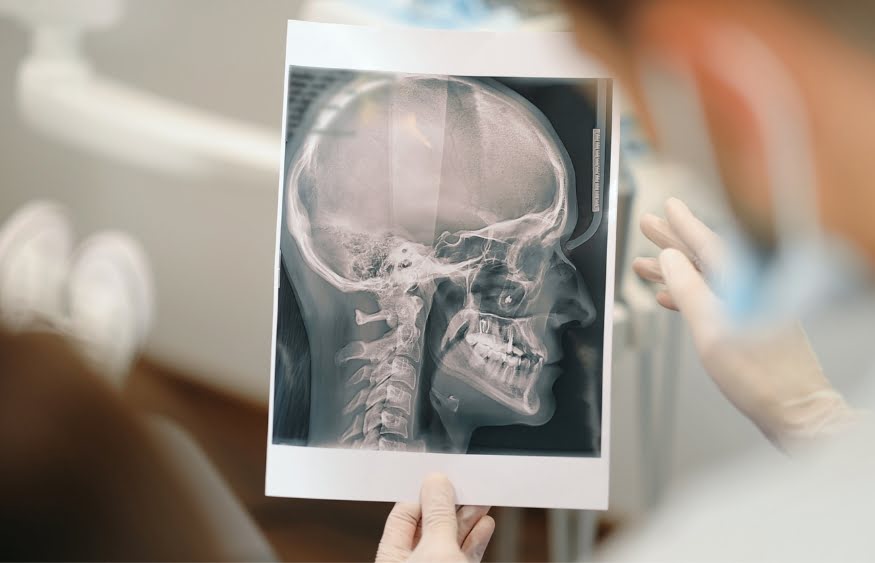 7 Cara Deteksi Dini Gangguan Tengkorak dengan Pemeriksaan Medis