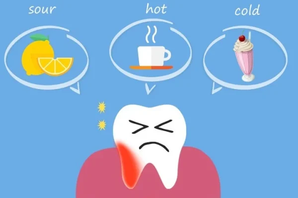 10 Cara Meredakan Gigi Ngilu karena Gigi Sensitif