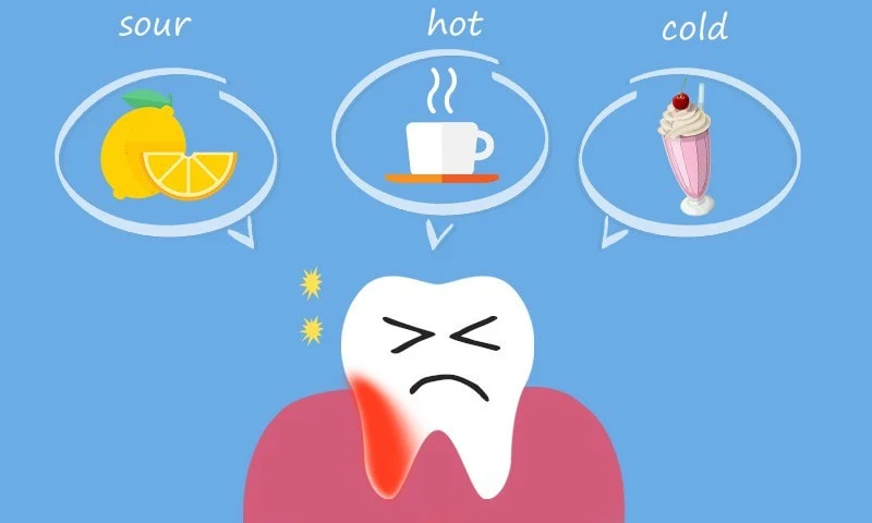10 Cara Meredakan Gigi Ngilu karena Gigi Sensitif